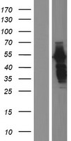 HIP55 (DBNL) Human Over-expression Lysates NM_001122956