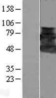 HIP55 (DBNL) Human Over-expression Lysates NM_014063