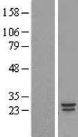 COMMD5 Human Over-expression Lysates NM_014066