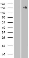 HIPK2 Human Over-expression Lysates NM_022740