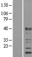 KLF15 Human Over-expression Lysates NM_014079