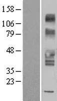 SLC43A3 Human Over-expression Lysates NM_017611