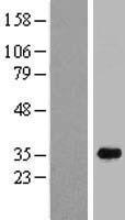 C16orf72 Human Over-expression Lysates NM_014117