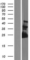 FAM156A Human Over-expression Lysates NM_014138
