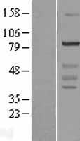WDR91 Human Over-expression Lysates NM_014149