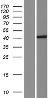 CCDC113 Human Over-expression Lysates NM_001142302