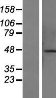 CCDC113 Human Over-expression Lysates NM_014157