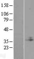 C1GALT1C1 Human Over-expression Lysates NM_001011551