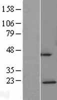 NDUFAF4 Human Over-expression Lysates NM_014165