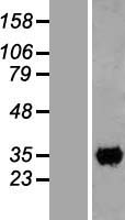 CCDC59 Human Over-expression Lysates NM_014167
