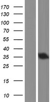CHMP4A Human Over-expression Lysates NM_014169