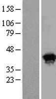 HSPC142 (BABAM1) Human Over-expression Lysates NM_001033549