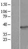 HSPC142 (BABAM1) Human Over-expression Lysates NM_014173