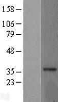 MRPL15 Human Over-expression Lysates NM_014175