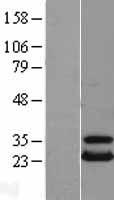 HSPC150 (UBE2T) Human Over-expression Lysates NM_014176