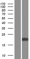 COMMD9 Human Over-expression Lysates NM_001101653