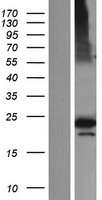 GTL3 (CFAP20) Human Over-expression Lysates NM_013242