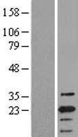 TMS1 (PYCARD) Human Over-expression Lysates NM_013258