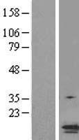 TMS1 (PYCARD) Human Over-expression Lysates NM_145183