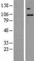TBK1 Human Over-expression Lysates NM_013254