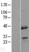 SAP30BP Human Over-expression Lysates NM_013260