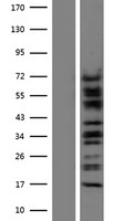 CTNNA3 Human Over-expression Lysates NM_013266