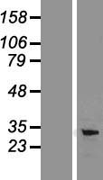 PD L1 (CD274) Human Over-expression Lysates NM_014143
