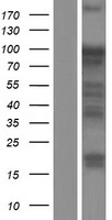 UHRF1 Human Over-expression Lysates NM_013282