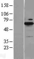 BLNK Human Over-expression Lysates NM_013314