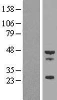 Tropomodulin 4 (TMOD4) Human Over-expression Lysates NM_013353