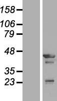 Tropomodulin 3 (TMOD3) Human Over-expression Lysates NM_014547