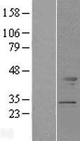 Tropomodulin 2 (TMOD2) Human Over-expression Lysates NM_014548