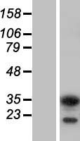 Activator of basal transcription 1 (ABT1) Human Over-expression Lysates NM_013375