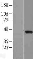 PARVB Human Over-expression Lysates NM_013327