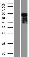 NCAPH2 Human Over-expression Lysates NM_014551
