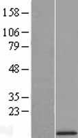 Cytochrome b c1 complex subunit 9 (UQCR10) Human Over-expression Lysates NM_013387