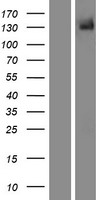 TRPM5 Human Over-expression Lysates NM_014555