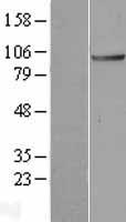 Apc2 (ANAPC2) Human Over-expression Lysates NM_013366