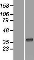 CNOT7 Human Over-expression Lysates NM_013354