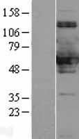 SNX8 Human Over-expression Lysates NM_013321