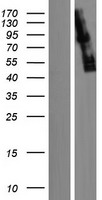 Striatin 4 (STRN4) Human Over-expression Lysates NM_001039877