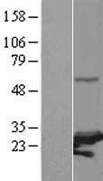 ls029893 psmc3ip human over expression lysates nm 013290 wb testing 1