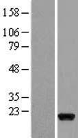 fast skeletal Myosin (MYLPF) Human Over-expression Lysates NM_013292