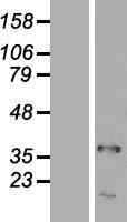 TRA2A Human Over-expression Lysates NM_013293