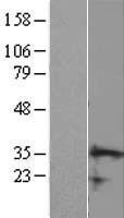 CCDC106 Human Over-expression Lysates NM_013301