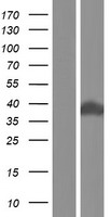 SNX15 Human Over-expression Lysates NM_013306