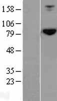 HOOK2 Human Over-expression Lysates NM_013312