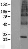 UBIAD1 Human Over-expression Lysates NM_013319