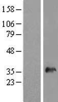 SNX11 Human Over-expression Lysates NM_152244