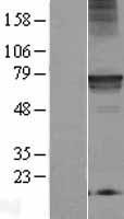 RMC1 Human Over-expression Lysates NM_013326
